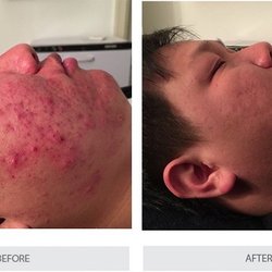 Advanced Skin Care Solutions