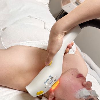Avant MedSpa - Medical Spas Near Me - Irvine, California