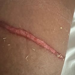 UCLA Health Marina del Rey Primary Care - Burn by kathryn goldrath