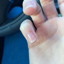 Bellezza Nails Spa - Cut finger