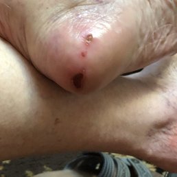 Grandmas heel the day after her pedicure.