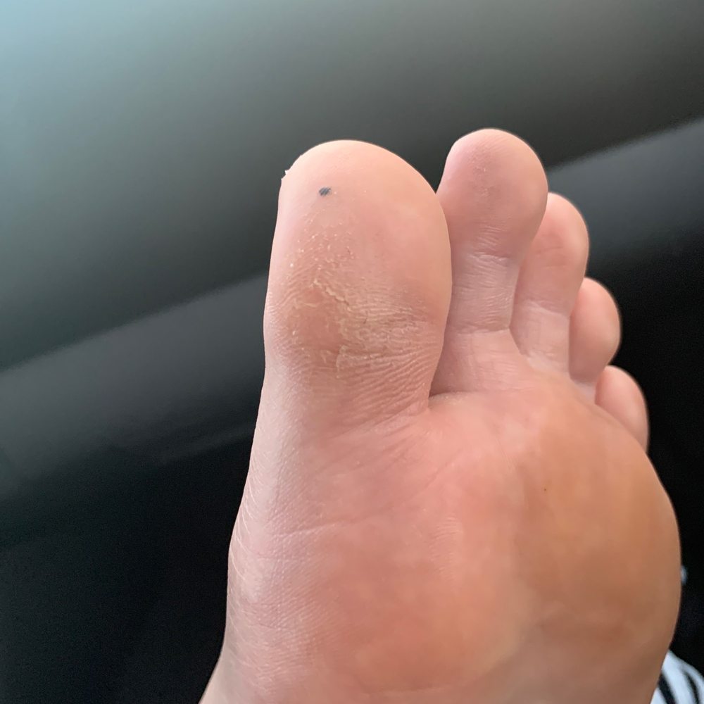 Steamboat Nails - crappy, half scrapped calluses - Nail Salons Near Me - Steamboat Springs, Colorado Steamboat Nails - crappy, half scrapped calluses - Nail Salons Near Me - Steamboat Springs, Colorado