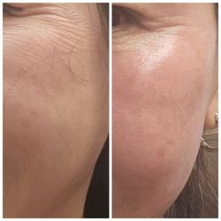 Jane Skin Care - #superjection( firming)