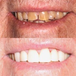Dental Studio West - Before and after dental results at Dental Studio West! Dentist in Cincinnati, OH.