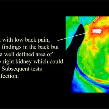 Wholistic Thermography - Diagnostic Imaging Near Me - Johnstown, Pennsylvania Wholistic Thermography - Diagnostic Imaging Near Me - Johnstown, Pennsylvania
