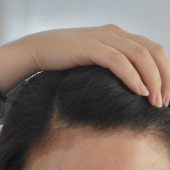 The Painted Nest Studio - stain on forehead - Hair Salons Near Me - Brea, California The Painted Nest Studio - stain on forehead - Hair Salons Near Me - Brea, California