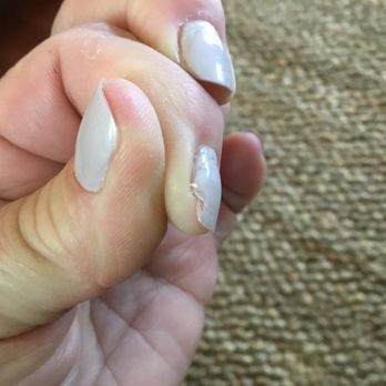 Floris Nail & Spa - Chunk of my natural nail missing due to painful removal process. - Nail Salons Near Me - Exton, Pennsylvania Floris Nail & Spa - Chunk of my natural nail missing due to painful removal process. - Nail Salons Near Me - Exton, Pennsylvania