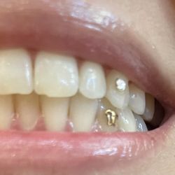 Ginger Hansen - Small tooth chip.