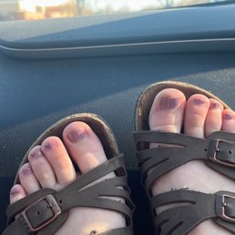 uneven and ridged pedicure uneven and ridged pedicure