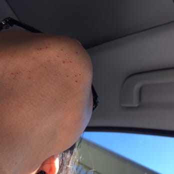 Super Eyebrow - Look at all those cuts!!!!!! - Hair Removal Near Me - Pittsburg, California Super Eyebrow - Look at all those cuts!!!!!! - Hair Removal Near Me - Pittsburg, California