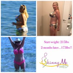 Photo of Skinny Me Med - Van Nuys, CA, US. Congratulations to our Summer Body Challenge Winner 2017!! Over 40lbs in 2 months!