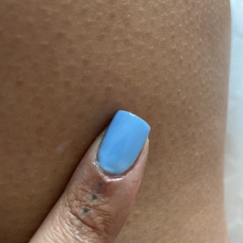Protop Nails - Cut my finger badly. Picture does not do it justice - Nail Salons Near Me - Watsonville, California