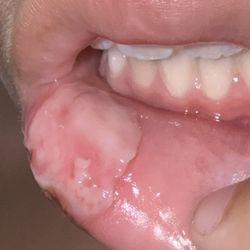 Dental Smiles For Kids