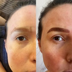 ChicSkinbyAna - Pls note that after picture was taken immediately after a procedure, therefore after 4-6 week healing process the color will fade by 40%