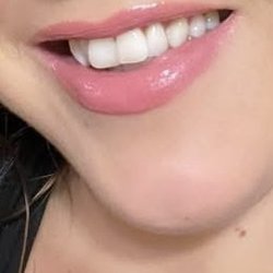 Anthony J Visconti III, DMD - Mouth with teeth?