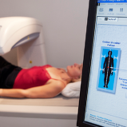 Starling Diagnostics - DEXA bone density scana