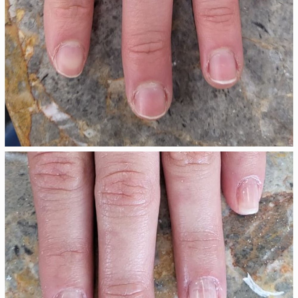 before and after before and after