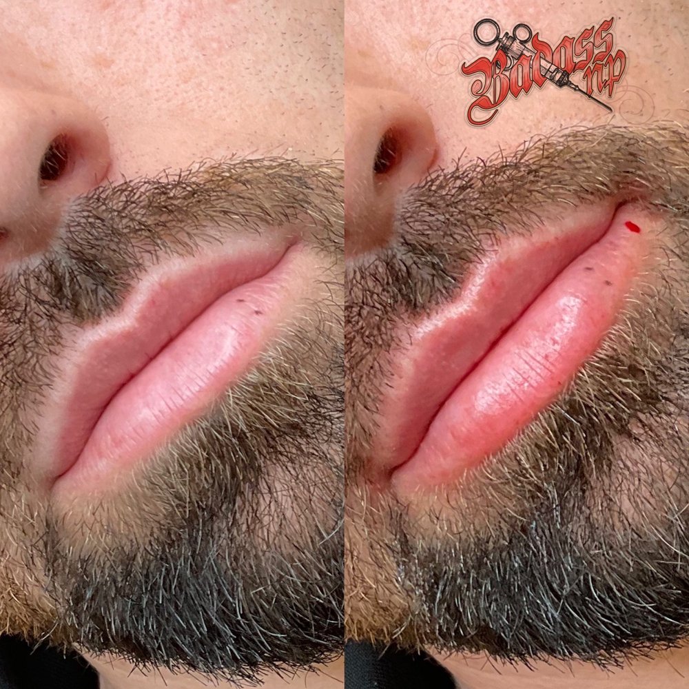Kristin Eliza, ARNP Medical Aesthetics Image