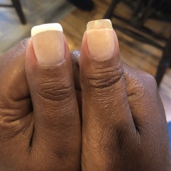 ManiLuxe Nail Care and Spa - 9 days after? Really? The thumb on the left is what they should both look like... - Day Spas Near Me - Baltimore, Maryland ManiLuxe Nail Care and Spa - 9 days after? Really? The thumb on the left is what they should both look like... - Day Spas Near Me - Baltimore, Maryland