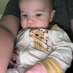 Federal Way Naturopathy - After three CST sessions with Dr. Colleen Hart, he can hold his head up and look straight on.