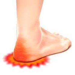 The Ideal Feet Store - Do yo have heel pain? We can Help!