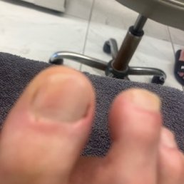 After tech cut cuticle
