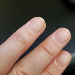 Extensive grooves and damage to my nails from a machiene that should only be used in a dentist office!