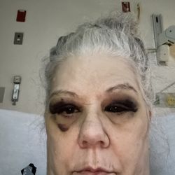 Mohave Eye Center - Palo Verde