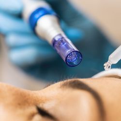 Skinfidence - Microneedling is one of the most effective ways to see dramatic skin results in a short amount of time!!!