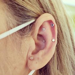 Lee Acupuncture - Ear Crystal therapy - fibromyalgia, wrist pain, stress management, hormone balance