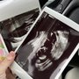 Photo of Stork Vision Ultrasound Imaging Center