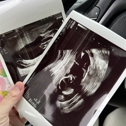Stork Vision Ultrasound Imaging Center - Here are the only ultrasound pictures I got (2).
