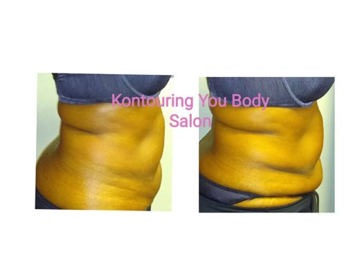 Kontouring You Body Salon