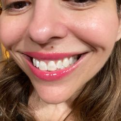 Khoi Nguyen, DDS - Zoom whitening