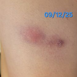 Georgia Skin & Cancer Cllinic
