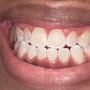 Photo of Ciera White Smile Bar