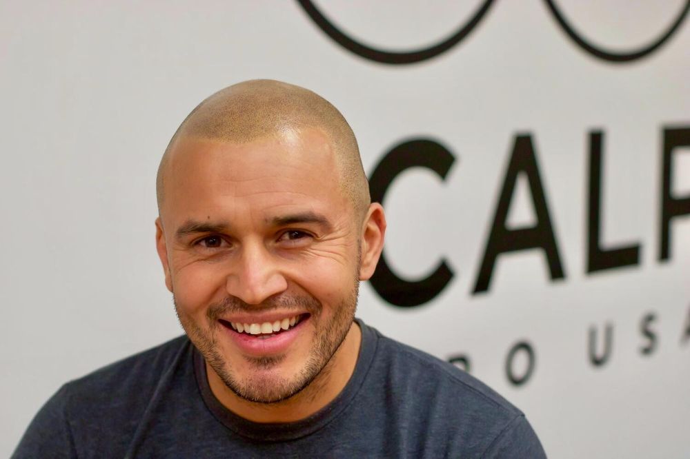 Scalp Micro USA Logo