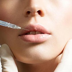 O'Donnell Vein and Laser - Fillers are non-surgical, minimally invasive treatment option to restore lost volume and reduce the appearance of signs of aging.
