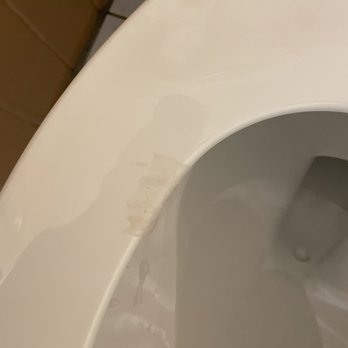 The Tiki - Toilet paper stuck to the toilet seat. - Resorts Near Me - Lake George, New York