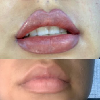 Permanent Makeup By Kimberly - Top photo shows my lips after the session, bottom lips are natural lips before the session. - Permanent Makeup Near Me - Rancho Cucamonga, California Permanent Makeup By Kimberly - Top photo shows my lips after the session, bottom lips are natural lips before the session. - Permanent Makeup Near Me - Rancho Cucamonga, California
