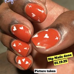 Cindy Nail - Dip nails on right hand 3 days after service.