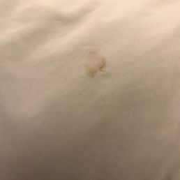 Blood stains on sheets in room #2 Blood stains on sheets in room #2