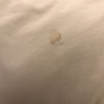 Sleep Inn & Suites Roseburg North Near Medical Center - Blood stains on sheets in room #2 - Hotels Near Me - Roseburg, Oregon Sleep Inn & Suites Roseburg North Near Medical Center - Blood stains on sheets in room #2 - Hotels Near Me - Roseburg, Oregon