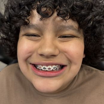 Braces By Garcia - Orthodontists Near Me - Temecula, California