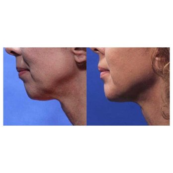 Restore, Curtis Perry MD - Cosmetic Surgeons Near Me - Whittier, California Restore, Curtis Perry MD - Cosmetic Surgeons Near Me - Whittier, California