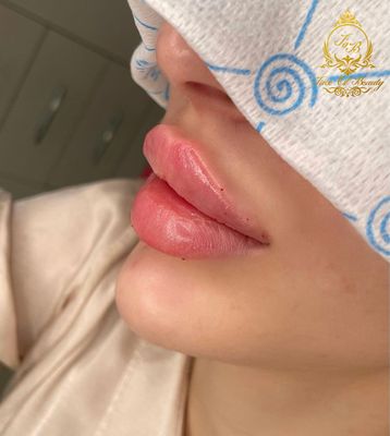 Face Of Beauty by null