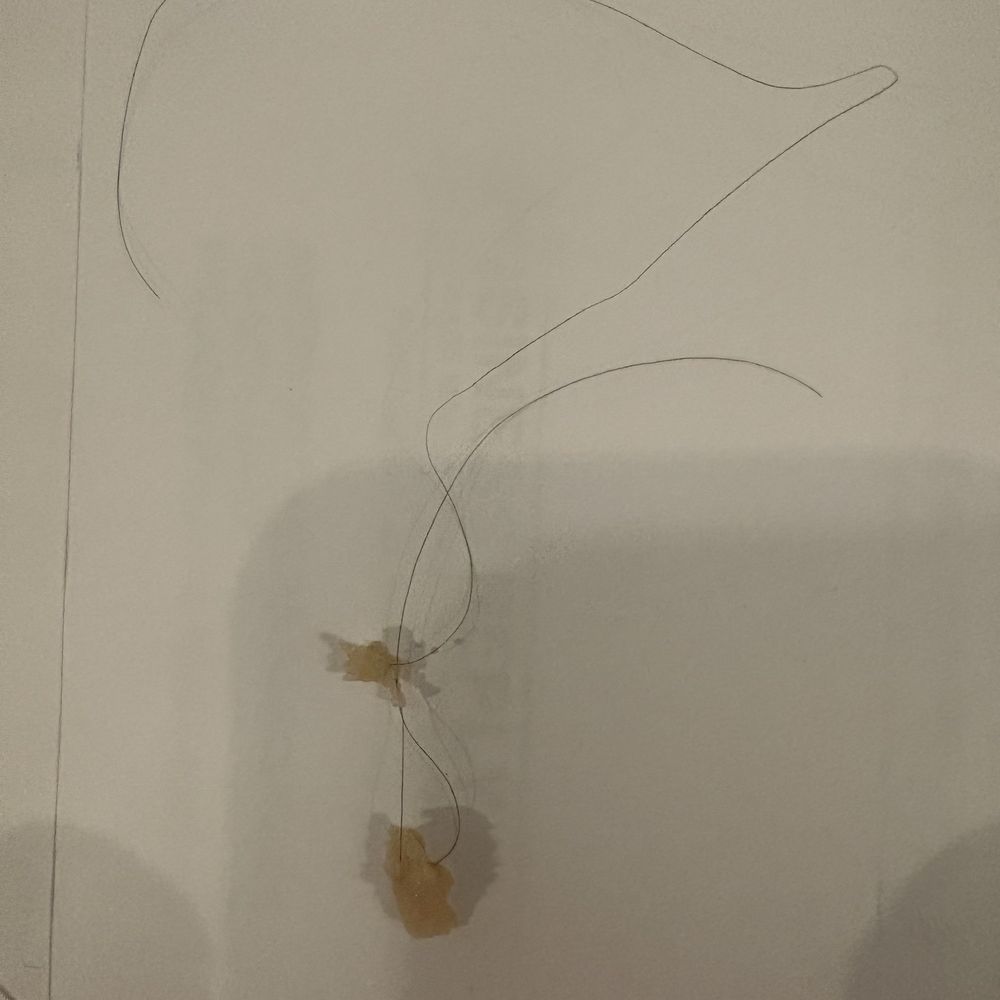Big Apple - Hair in my food - Chinese Near Me - Rockaway Park, New York