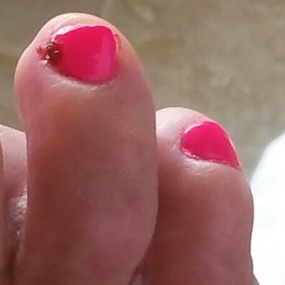 Lana's Diamond Salon - Nicked infected toe. - Nail Salons Near Me - Downey, California