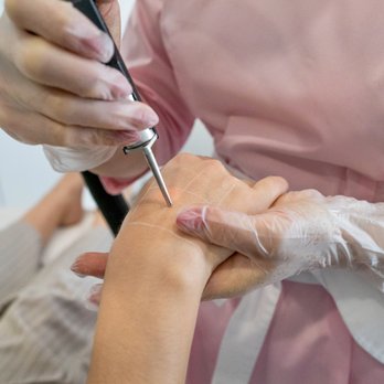 Serene Max - Treatment in progress - Laser Hair Removal Near Me - New York, New York