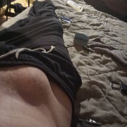 General Surgery of Lancaster - My hernia